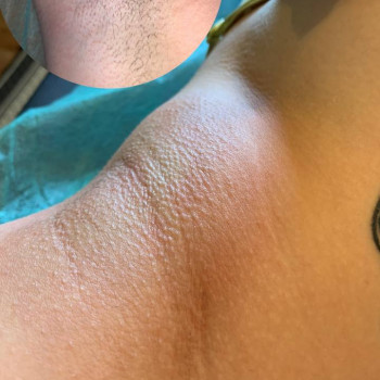 Шугаринг
                    Салон краси J-BLENS Суми