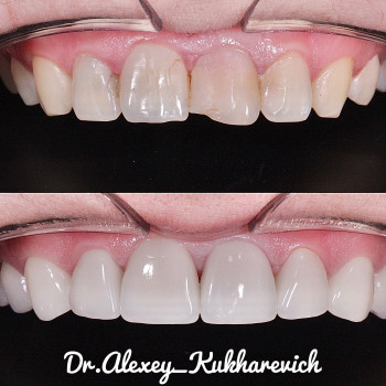 Олексій Кухаревич, Рівне Фото - 28