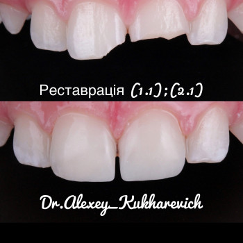 Олексій Кухаревич, Рівне Фото - 40