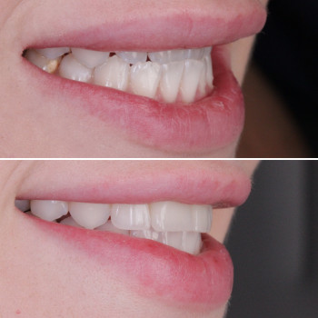 Олексій Кухаревич, Рівне Фото - 44