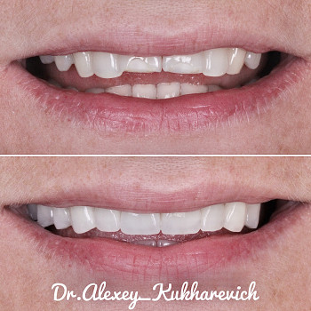 Олексій Кухаревич, Рівне Фото - 46