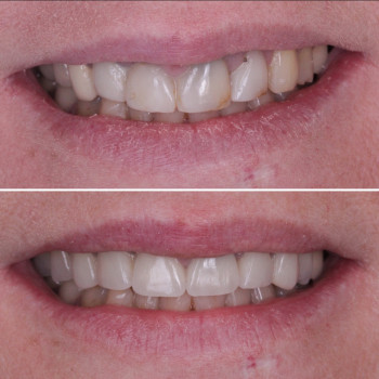 Олексій Кухаревич, Рівне Фото - 51