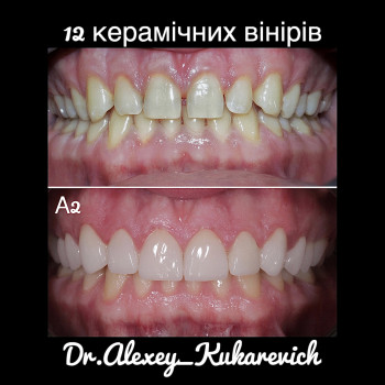 Олексій Кухаревич, Рівне Фото - 52