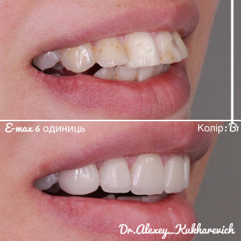 Олексій Кухаревич, Рівне Фото - 58