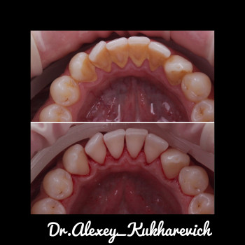 Олексій Кухаревич, Рівне Фото - 63