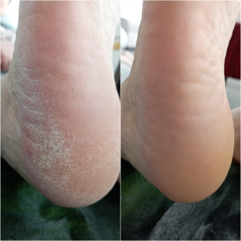 Фото з портфоліо майстра Яна Резнікова (майстер манікюру, Винники)