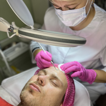 Механічна чистка обличчя
                    Косметолог-эстетист Наталія Борисполь