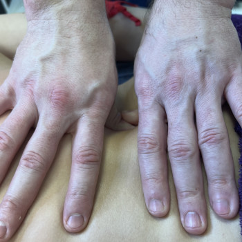 Миопрессура, триггерный массаж
                    Реабилитолог Алекс Днепр