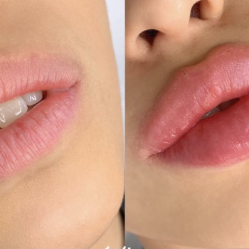 Вікторія Вінниченко, Львів Фото - 5