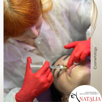 Аугментація губ (збільшення губ) від косметолога Наталії Філь

   