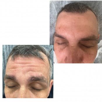 Наталья Грицай, Днепр Фото - 95