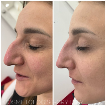 Наталья Грицай, Днепр Фото - 98