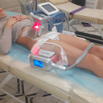 3 насадкі 
кріоліполіз живіт +стегна