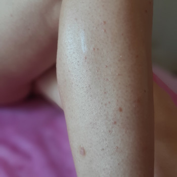 Ольга Селістрян, Николаев Фото - 20