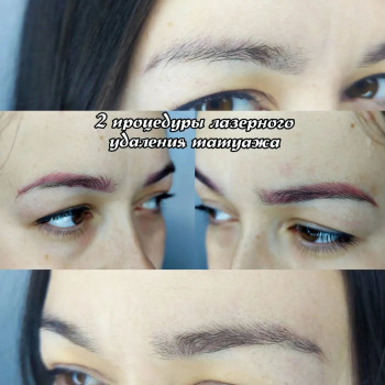 Роман Voroschuk, Кропивницкий Фото - 7