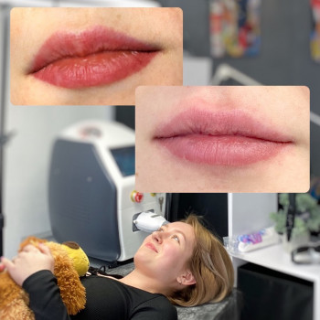 Роман Voroschuk, Кропивницкий Фото - 8