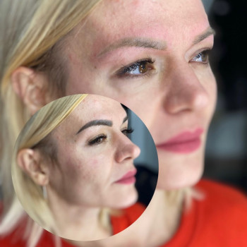 Роман Voroschuk, Кропивницкий Фото - 9