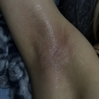 Роксолана Тернікова, Одеса Фото - 5