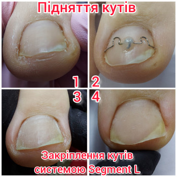 Ольга Подолог, Бровари Фото - 15