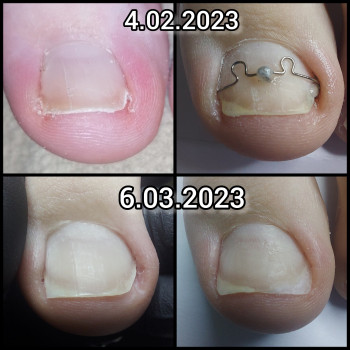 Ольга Подолог, Бровари Фото - 17