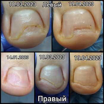 Ольга Подолог, Бровари Фото - 18