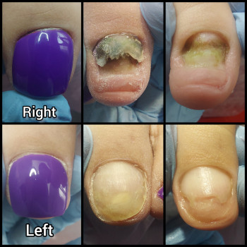 Ольга Подолог, Бровари Фото - 19