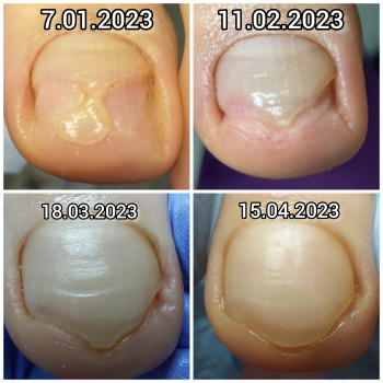 Ольга Подолог, Бровари Фото - 20