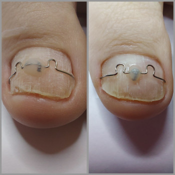 Ольга Подолог, Бровари Фото - 26