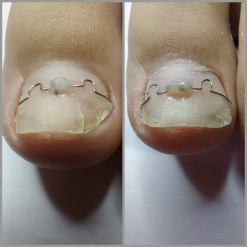 Ольга Подолог, Бровари Фото - 27