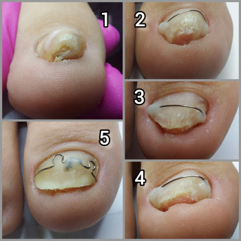 Ольга Подолог, Бровари Фото - 30