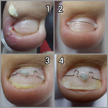 Ольга Подолог, Бровари Фото - 31