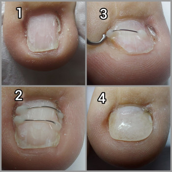 Ольга Подолог, Бровари Фото - 32