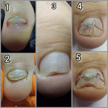 Ольга Подолог, Бровари Фото - 33