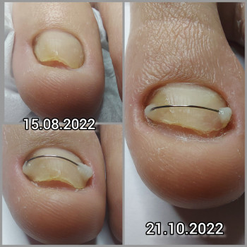 Ольга Подолог, Бровари Фото - 38