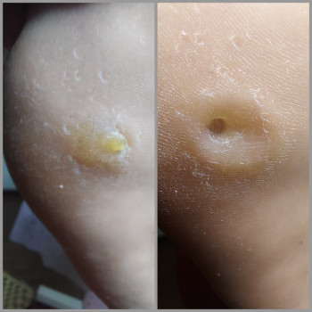 Ольга Подолог, Бровари Фото - 40