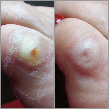 Ольга Подолог, Бровари Фото - 42