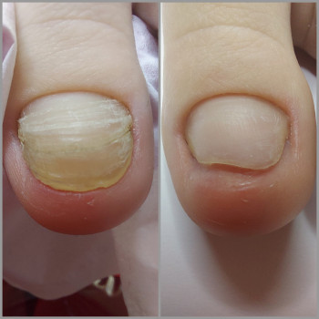 Ольга Подолог, Бровари Фото - 43