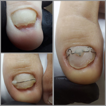 Корекційні системи
                    Подолог Ольга Бровары