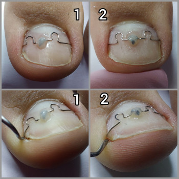 Корекційні системи
                    Подолог Ольга Бровары