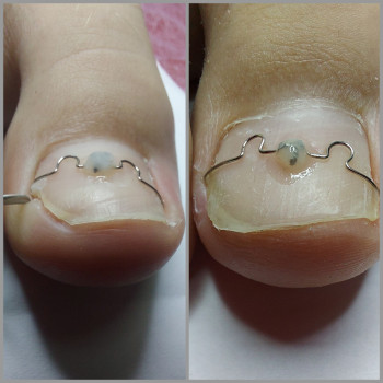 Корекційні системи
                    Подолог Ольга Бровары