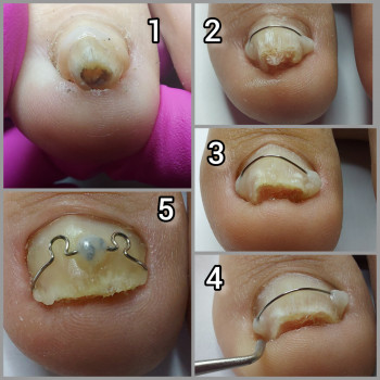 Корекційні системи
                    Подолог Ольга Бровары