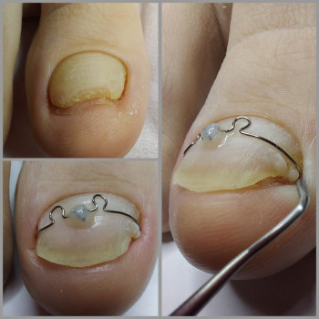 Корекційні системи
                    Подолог Ольга Бровары