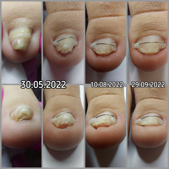 Корекційні системи
                    Подолог Ольга Бровары