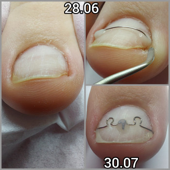 Корекційні системи
                    Подолог Ольга Бровары