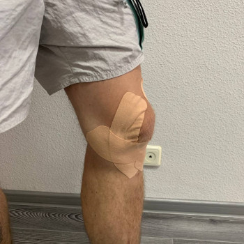 тейпування