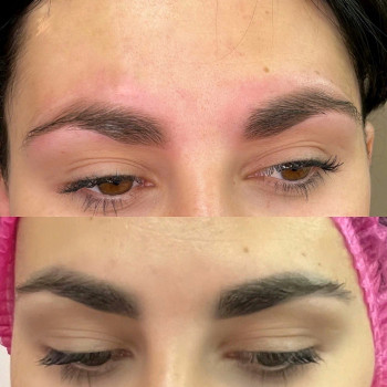 Видалення татуажу, перманенту лазер/ремувер
                    Мастер перманентного макияжа Тетяна Киев