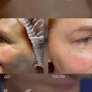 Ольга Сігорских, Київ Фото - 29