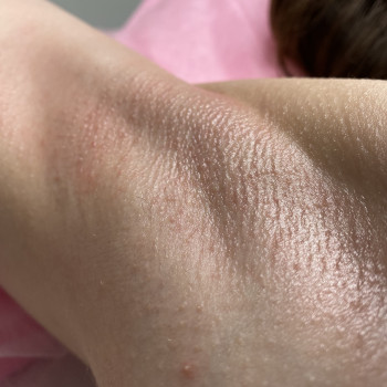 Юлия Смульская, Одесса Фото - 6