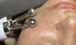 BIO мікротоки Косметолог-эстетист Тетяна Мукачево