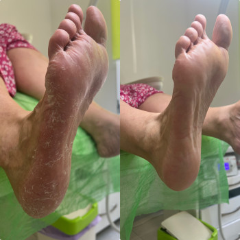 Ірина Дідківська, Ірпінь Фото - 40